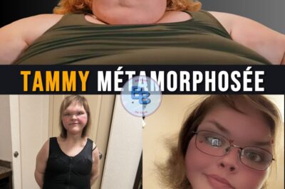 Tammy, star de télé-réalité « terrifiée » après avoir perdu 230 kilos : 8 heures de chirurgie et 7 kilos de peau coupés