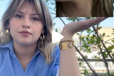 Marine Delplace en pleine réaction allergique, elle dévoile son visage “gonflé” et appelle ses fans à l’aide