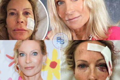 “Je ne me souviens de rien” : Rebecca Hampton a perdu la mémoire, les terribles séquelles après son grave accident