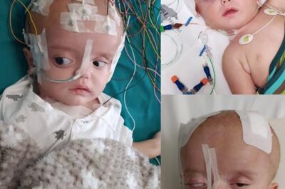 « Le bébé qui a perdu la vue mais pas son courage ».