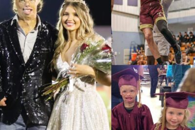 « De 84% de brûlures au roi du bal de promo : le miracle de Dylan Mills ».