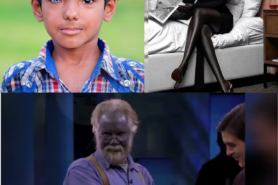 10 HUMAINS RARES QUI EXISTENT VRAIMENT !…